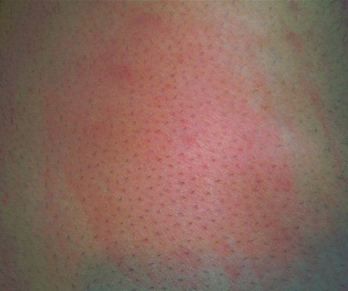 meltedleg-iphone3g1.jpg